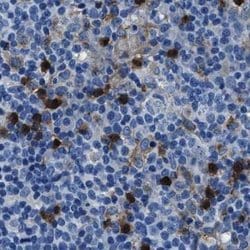Invitrogen FGL2 Polyclonal Antibody 100 &mu;L; Unconjugated:Antibodies,