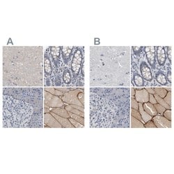 Invitrogen MURC Polyclonal Antibody 100 &mu;L; Unconjugated:Anticuerpos