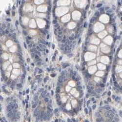 Invitrogen MURC Polyclonal Antibody 100 &mu;L; Unconjugated:Anticuerpos