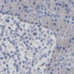 Invitrogen MURC Polyclonal Antibody 100 &mu;L; Unconjugated:Anticuerpos