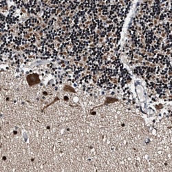 Invitrogen PRRC2B Polyclonal Antibody 100 &mu;L; Unconjugated:Antibodies,