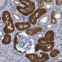 Invitrogen ALAD Polyclonal Antibody 100 &mu;L; Unconjugated:Antibodies,
