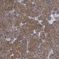 Invitrogen ALAD Polyclonal Antibody 100 &mu;L; Unconjugated:Antibodies,