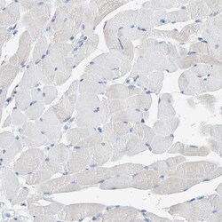 Invitrogen ALAD Polyclonal Antibody 100 &mu;L; Unconjugated:Antibodies,