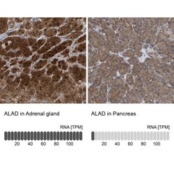 Invitrogen ALAD Polyclonal Antibody 100 &mu;L; Unconjugated:Antibodies,
