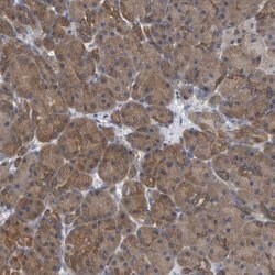 Invitrogen ALAD Polyclonal Antibody 100 &mu;L; Unconjugated:Antibodies,