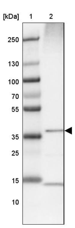 Invitrogen ALAD Polyclonal Antibody 100 &mu;L; Unconjugated:Antibodies,