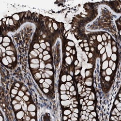Invitrogen TCP-1 theta Polyclonal Antibody 100 &mu;L; Unconjugated:Antibodies,