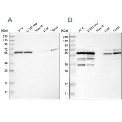 Invitrogen TCP-1 theta Polyclonal Antibody 100 &mu;L; Unconjugated:Antibodies,