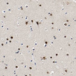 Invitrogen NOP58 Polyclonal Antibody 100 &mu;L; Unconjugated:Antibodies,