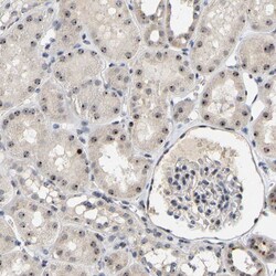Invitrogen NOP58 Polyclonal Antibody 100 &mu;L; Unconjugated:Antibodies,