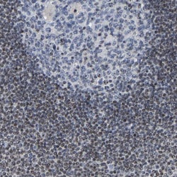 Invitrogen NOP58 Polyclonal Antibody 100 &mu;L; Unconjugated:Antibodies,