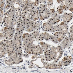 Invitrogen NOP58 Polyclonal Antibody 100 &mu;L; Unconjugated:Antibodies,