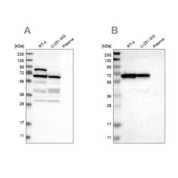 Invitrogen NOP58 Polyclonal Antibody 100 &mu;L; Unconjugated:Antibodies,