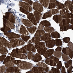 Invitrogen USP29 Polyclonal Antibody 100 &mu;L; Unconjugated:Antibodies,