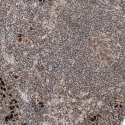 Invitrogen ZCCHC7 Polyclonal Antibody 100 &mu;L | Buy Online | Invitrogen&trade; | Fisher Scientific