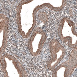 Invitrogen ZCCHC7 Polyclonal Antibody 100 &mu;L | Buy Online | Invitrogen&trade; | Fisher Scientific