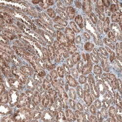Invitrogen ZCCHC7 Polyclonal Antibody 100 &mu;L | Buy Online | Invitrogen&trade; | Fisher Scientific
