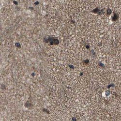 MYO18A Polyclonal Antibody, Invitrogen 100 &mu;L; Unconjugated:Antibodies,
