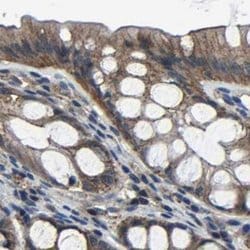 MYO18A Polyclonal Antibody, Invitrogen 100 &mu;L; Unconjugated:Antibodies,