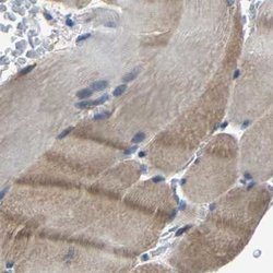 MYO18A Polyclonal Antibody, Invitrogen 100 &mu;L; Unconjugated:Antibodies,