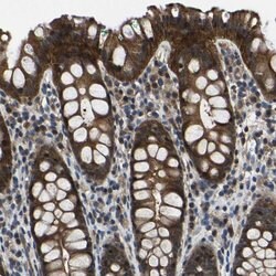 MYO18A Polyclonal Antibody, Invitrogen 100 &mu;L; Unconjugated:Antibodies,