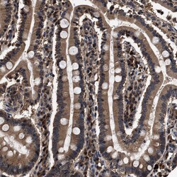 Invitrogen ZNF313 Polyclonal Antibody 100 &mu;L | Buy Online | Invitrogen&trade; | Fisher Scientific