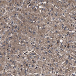 Invitrogen ZNF313 Polyclonal Antibody 100 &mu;L | Buy Online | Invitrogen&trade; | Fisher Scientific