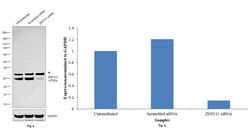 Invitrogen ZNF313 Polyclonal Antibody 100 &mu;L | Buy Online | Invitrogen&trade; | Fisher Scientific