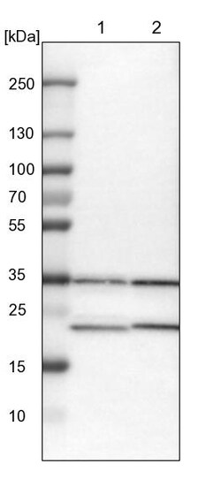 Invitrogen ZNF313 Polyclonal Antibody 100 &mu;L | Buy Online | Invitrogen&trade; | Fisher Scientific