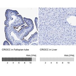 Invitrogen CROCC Polyclonal Antibody 100 &mu;L; Unconjugated:Anticorps,