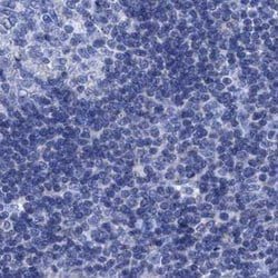Invitrogen CROCC Polyclonal Antibody 100 &mu;L; Unconjugated:Anticorps,