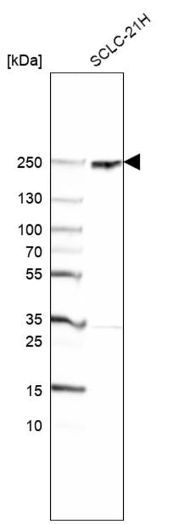 Invitrogen CROCC Polyclonal Antibody 100 &mu;L; Unconjugated:Anticorps,