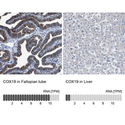 Invitrogen COX19 Polyclonal Antibody 100 &mu;L; Unconjugated:Antibodies,