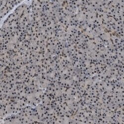 C9orf78 Polyclonal Antibody:Antibodies, Polyclonal