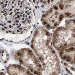 C9orf78 Polyclonal Antibody:Antibodies, Polyclonal