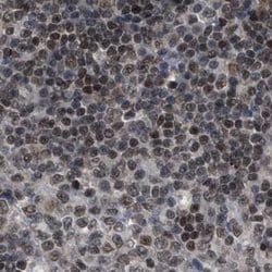 C9orf78 Polyclonal Antibody:Antibodies, Polyclonal