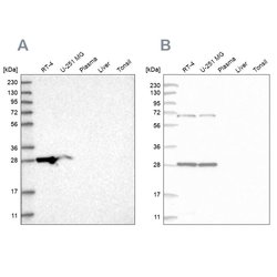 Invitrogen MRPL10 Polyclonal Antibody 100 &mu;L; Unconjugated:Antibodies,