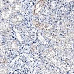 Invitrogen KIFC3 Polyclonal Antibody 100 μL; Unconjugated:Antibodies,