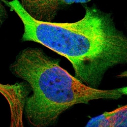 Invitrogen PHGDH Polyclonal Antibody 100 &mu;L; Unconjugated:Antibodies,