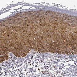Invitrogen PHGDH Polyclonal Antibody 100 &mu;L; Unconjugated:Antibodies,
