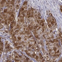 Invitrogen PHGDH Polyclonal Antibody 100 &mu;L; Unconjugated:Antibodies,