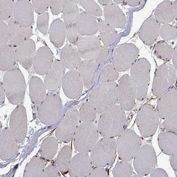 Invitrogen PHGDH Polyclonal Antibody 100 &mu;L; Unconjugated:Antibodies,