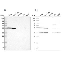 Invitrogen PHGDH Polyclonal Antibody 100 &mu;L; Unconjugated:Antibodies,