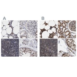 Invitrogen C9orf78 Polyclonal Antibody 100 &mu;L | Buy Online | Invitrogen&trade; | Fisher Scientific