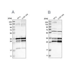 Invitrogen C9orf78 Polyclonal Antibody 100 &mu;L | Buy Online | Invitrogen&trade; | Fisher Scientific