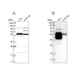 Invitrogen BAIAP2L1 Polyclonal Antibody 100 &mu;L; Unconjugated:Antibodies,