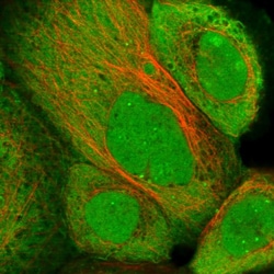 Invitrogen ZNF276 Polyclonal Antibody 100 &mu;L; Unconjugated:Antibodies,