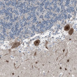 Invitrogen ZNF276 Polyclonal Antibody 100 &mu;L; Unconjugated:Antibodies,