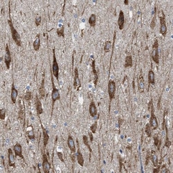 Invitrogen WDR60 Polyclonal Antibody 100 &mu;L; Unconjugated:Antibodies,